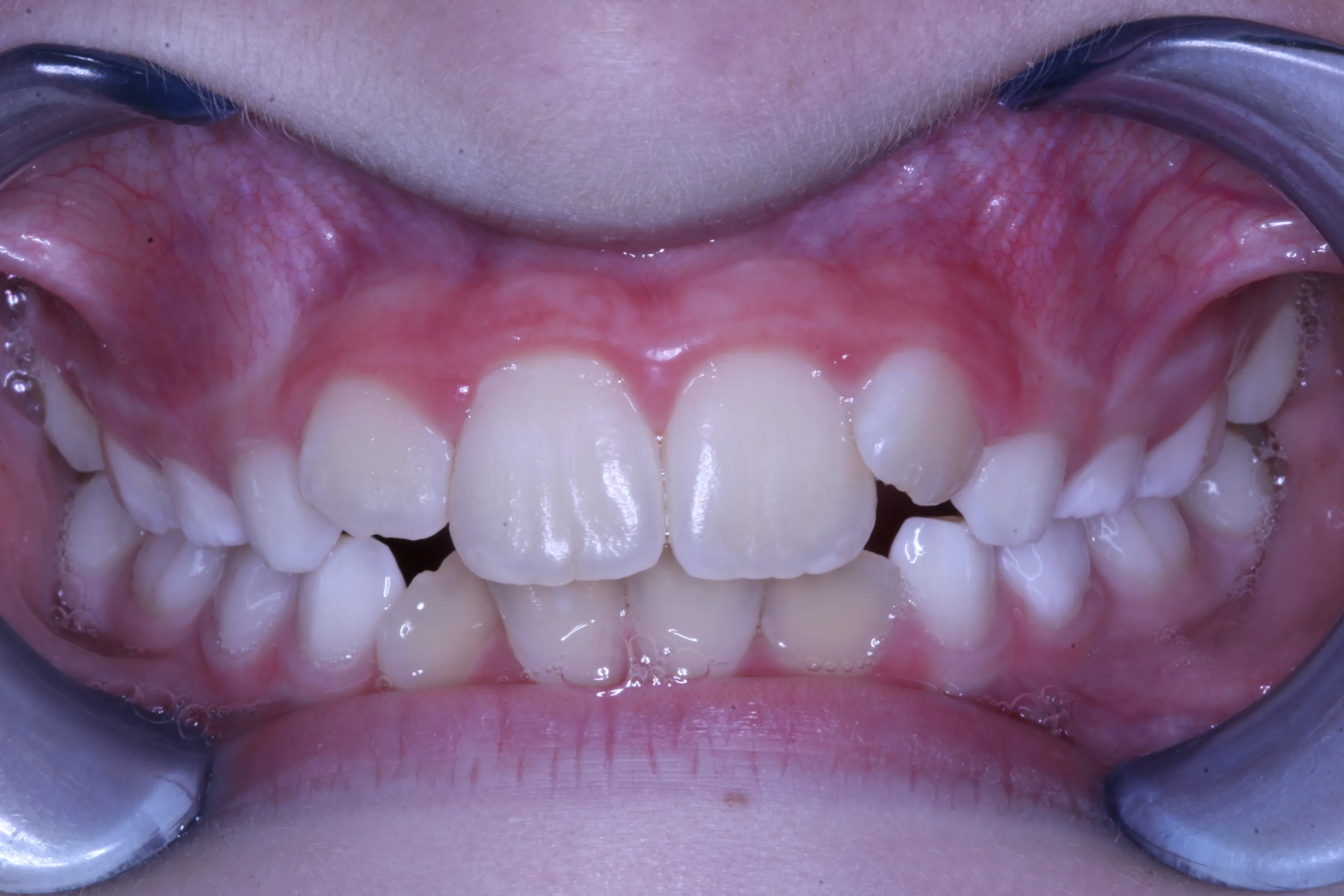 smile-gallery gallery